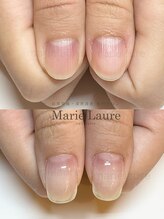 マリーロール 淀屋橋本店(Marie Laure)/深爪矯正/自爪風/自爪育成