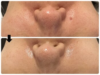 エフェクト 塚口店(effect)/Before After 40代/6回目