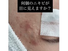 スキン ラボ ケー(Skin lab K)