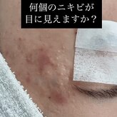 スキン ラボ ケー(Skin lab K)