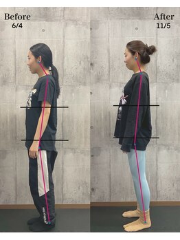 エミット(emit)/ビフォーアフター