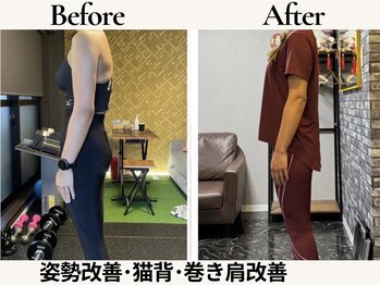 レガリス(REGALIS)/before/after 姿勢改善