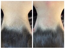 アットユウ(@yu)/シュガーリング《うなじ》