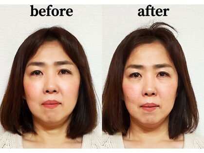 ベレディオ鍼灸整骨院(Belledio鍼灸整骨院)の写真