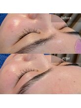 フリージア(Freesia)/産毛ないだけで艶々美肌の誕生◎