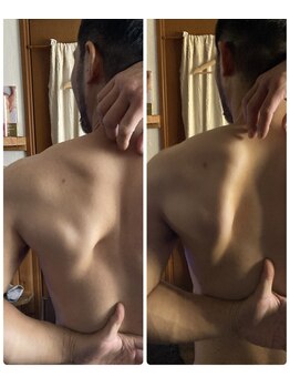 ハーモニー(Harmony)/肩甲骨の詰まり取って可動域up