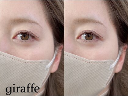 ジラフ(giraffe)の写真