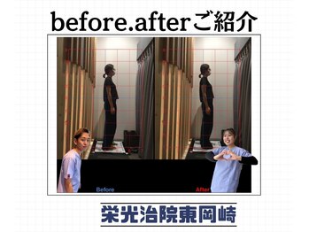 栄光治院 整体院東岡崎/岡崎整体/肩こり/猫背矯正/姿勢