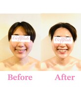 セルフィッシュ(Cellfish)/小顔×美容整体