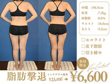 ピュアノア 垂水店の雰囲気（〈痩身人気No.1〉医師監修の垢抜けダイエット、後ろ姿は別人級?!）