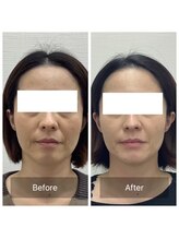 ハリナチュレ 那覇店(HARINATURE)/Before/After