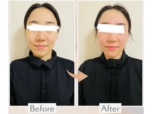 ヨサパーク レイ 等々力(YOSA PARK Ray)/お客様の変化　全身水素コース