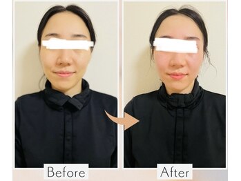 ヨサパーク レイ 等々力(YOSA PARK Ray)/お客様の変化　全身水素コース