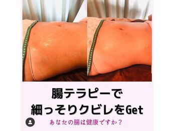 ビューティーツリー(Beauty Tree)/【ズボンがゆるゆる】お腹も激変