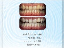 ハルロス(harlos)/着色汚れもしっかりケア！