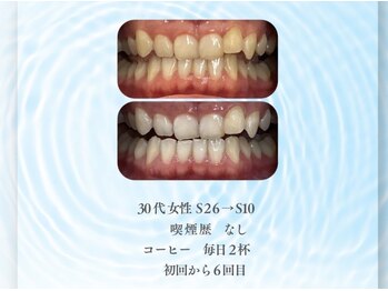 ハルロス(harlos)/着色汚れもしっかりケア！