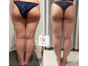 マシェリ 吉祥寺(Macherie)/脂肪燃焼 10ml導入