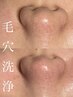 【毛穴の汚れ・黒ずみもスッキリ】毛穴洗浄×ピーリング