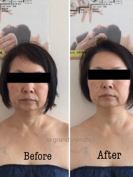 ル グラン ヤマテ(Le grand Yamate)/肩こり、首こりケアで、、。