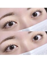 フィールリファイン(Feel Refine)/ラッシュリフト