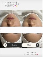 ファミーユ(famille)/ハイドロジェリー