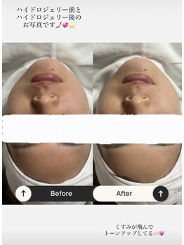 ファミーユ(famille)/ハイドロジェリー