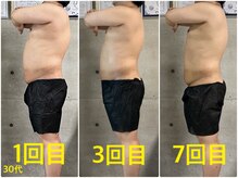 ペリー(PELLY)/男性30代　before after