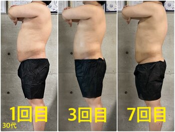 ペリー(PELLY)/男性30代 before after