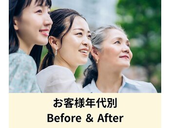 バランスアップラボ(バランスアップLAB)/お客様のビフォーアフター
