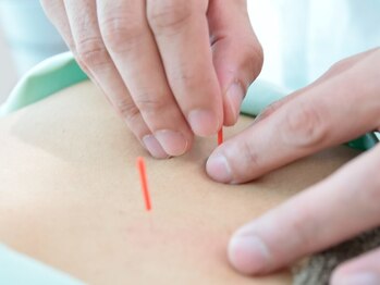 とだ鍼灸院 接骨院の写真/身体の悩みを丁寧にカウンセリング◎完全個室で豊富な施術メニュー♪おまかせコースも！初回限定クーポン有