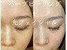 当店満足度No1★【ハ-ブピ-リング×光フォト】しみ、くすみ改善 22000→15800