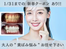 エンコロレ(encolore)