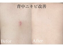 レア 姫路店(le'a)/気になるボディケアも◎