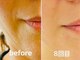 RKボディアンドフェイシャルサロン(RK body&facial salon)の写真/老け顔脱出をサポート！セルラムで細胞からアプローチ。たるみやエイジング悩みへハリツヤ溢れる肌へ♪