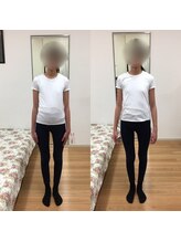 エスコート芦屋サロン/反り腰はポッコリおなかの元