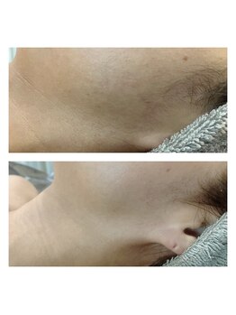 エリー(ERIE)/【艶肌Wax】もみあげラインも！