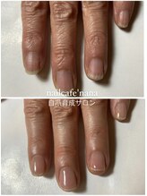 ネイルカフェ ナナ(nailcafe'nana)/自爪育成矯正