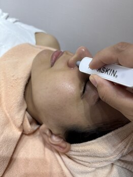 カナサ 城間店(KANASA)/毛穴洗浄