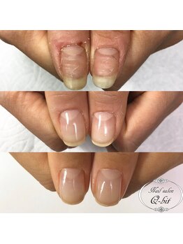 ネイルサロン キュービット(Q-bit)/