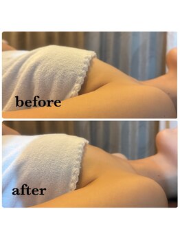 アンサー(ANSWER)/ボディ悩みもお任せ下さい