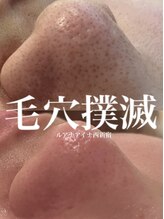 ルアナアイナ(Luana Aina) 肌質 改善