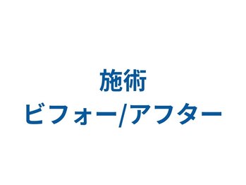 鈴家/整体×骨格矯正/猫背/巻き肩
