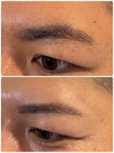 スリーピース(3Peace)/BEFORE／AFTER