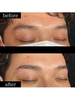 ユー 千葉駅前店(you)/症例写真