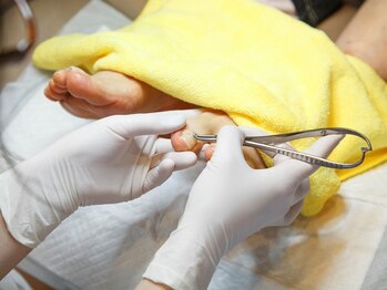 ドクターネイル爪革命 和歌山/施術イメージ