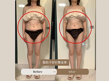 パラアモール(Paraamor)/気づいたらワンサイズダウン