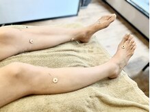 リラ鍼灸接骨院(Rela鍼灸接骨院)/全身しんきゅう