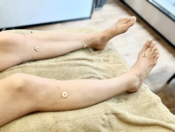 リラ鍼灸接骨院(Rela鍼灸接骨院)/全身しんきゅう