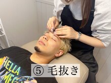 モア 福岡天神(More)/痛みを最小限に抑え、微調整