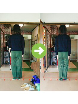 サプライズ整体院/30代ママさんの産後の骨盤初回